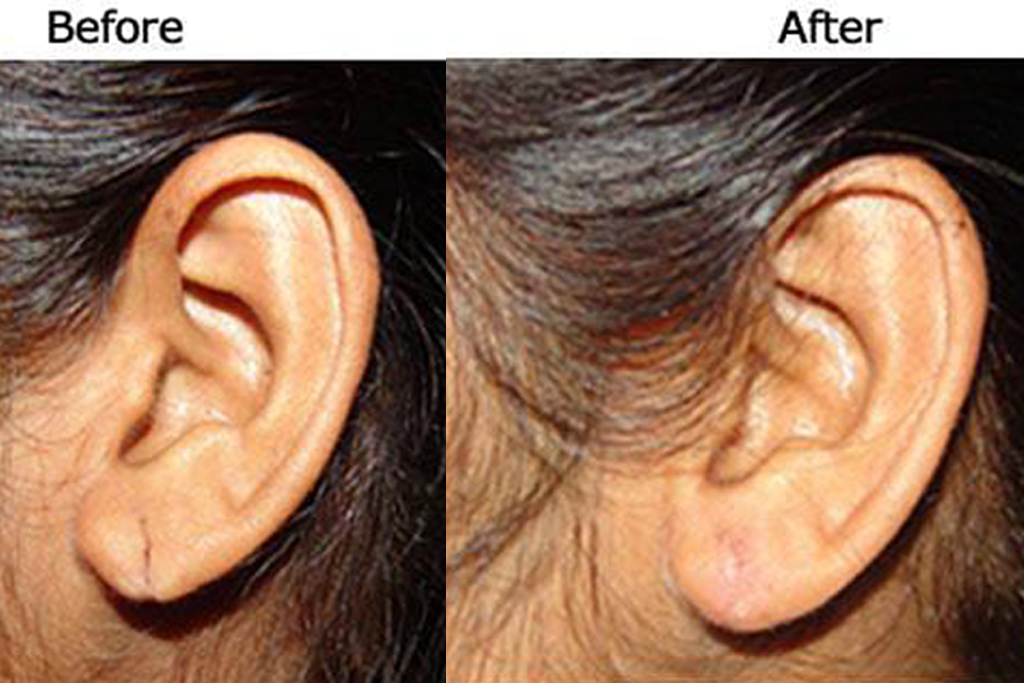 ear